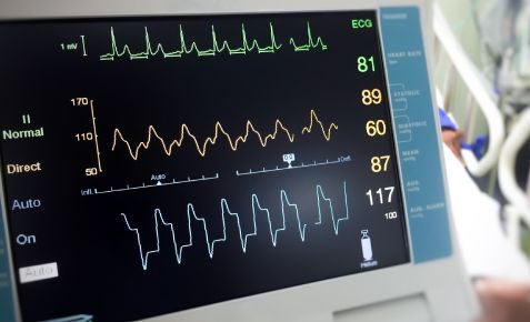 what does an ekg tech do