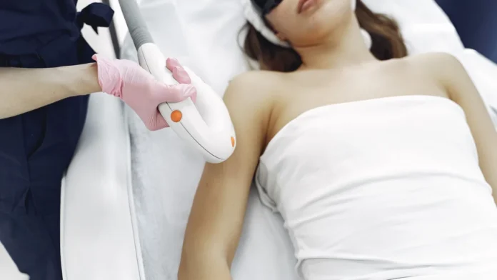 Laser Hair Removal Laser hair removal treatment on the skin