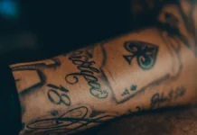Laser Tattoo Removal: Sessions, Cost and Fading Expectations Tattoo on a forearm before removal