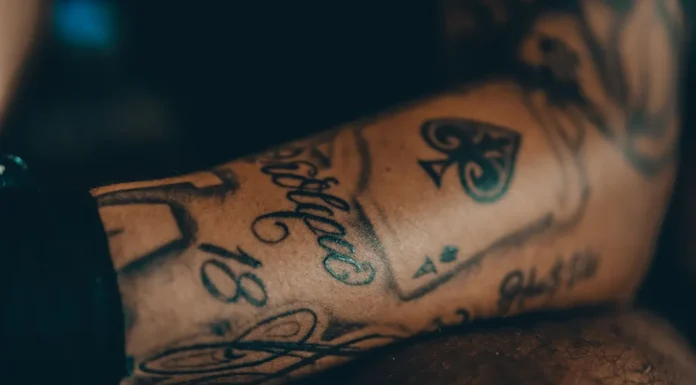 Laser Tattoo Removal: Sessions, Cost and Fading Expectations Tattoo on a forearm before removal